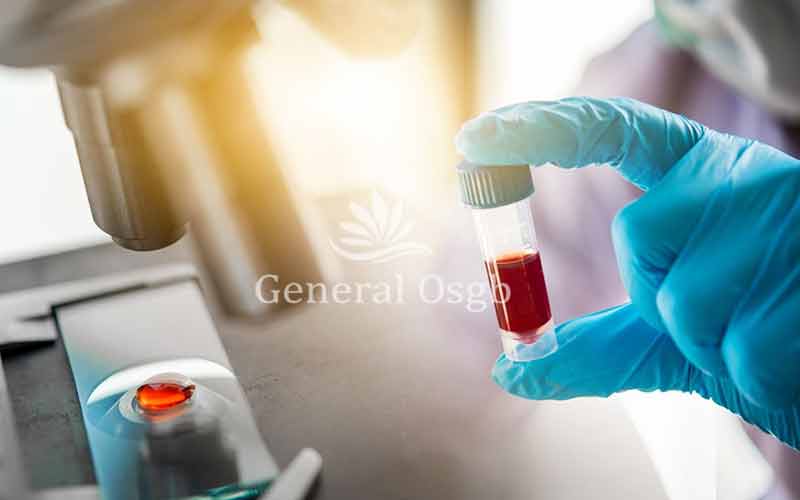 Covid-19 PCR ve Antikor Testi - General OSGB
