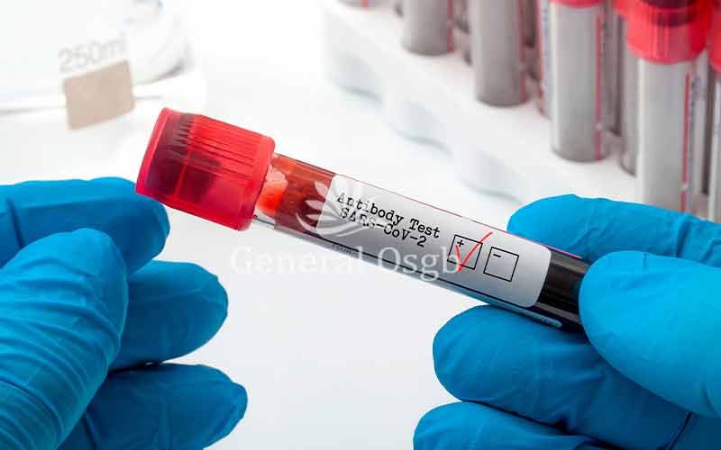 Covid-19 PCR ve Antikor Testi